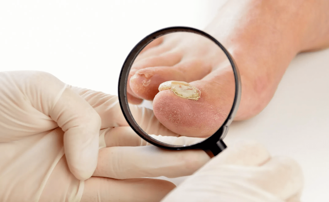 Diagnostikoak